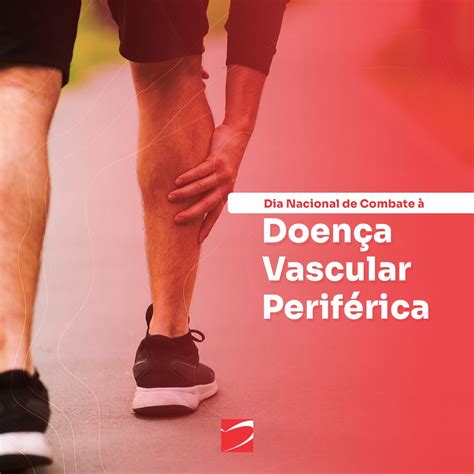 Doença Vascular Periférica Icor Instituto Do Coração De Santa Maria