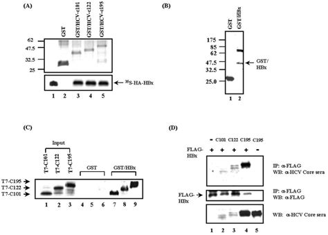 HBx Interacts With HCV Core Protein Both In Vitro And In Vivo A In