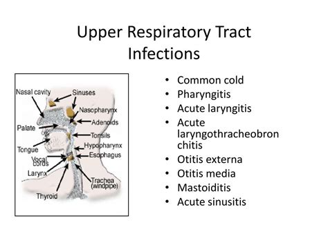 Ppt Upper Respiratory Tract Infections And Influenza Powerpoint Presentation Id 6305206