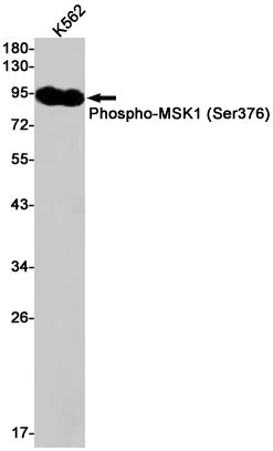 Phospho Msk Ser Rabbit Mab Wb Ihc P Ip Buy Now