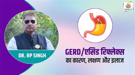 Gerd एसिड रिफ्लेक्स का कारण लक्षण और इलाज Gastroesophageal Reflux