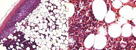 Adipose Tissue And Bone Marrow Elements Partially Surrounded By Download Scientific Diagram