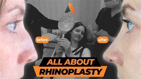 All About Rhinoplasty Answer Plastic Surgery Plasticsurgery Rhinoplasty Youtube