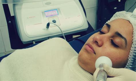 Clinica Aqua No Mundo Da Estetica Radiofrequencia Facial