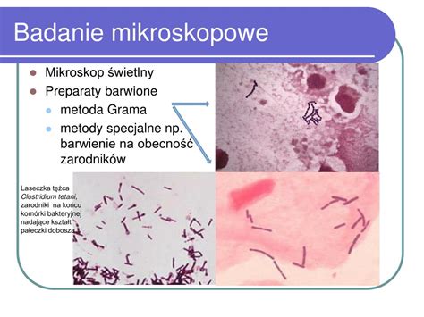 Ppt Metody Detekcji I Identyfikacji Bakterii Powerpoint Presentation