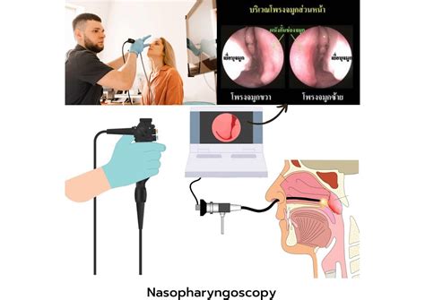 การตรวจโพรงจมูกด้วยการส่องกล้อง Nasopharyngoscopy โรงพยาบาลขอนแก่นราม