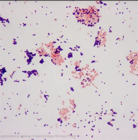 Lab Staining Microorganisms Microbiology Flashcards Quizlet