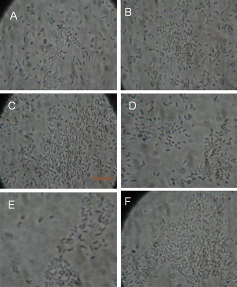 Demonstration Of Cell Surface Hydrophobicity A Spontaneous