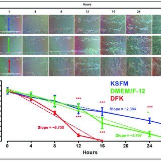 Wound Healing Assay Of Okf Tert Cells Grown In Ksfm Dmem F And