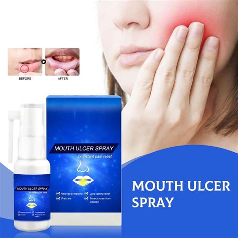 Canker Relief Spraybreath Spray For Bad Breathherbal Mouth Spray