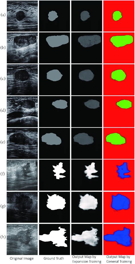 Comparison of test results in breast ultrasound images.... | Download ...