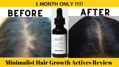 Minimalist Hair Serum Review Minimalist Hair Growth Actives Review