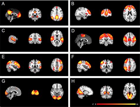 Resting State Networks Rsns Identified As Anatomically And