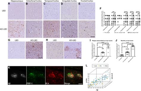 Amyloid Beta Aβ Plaques Promote Seeding and Spreading of Alpha