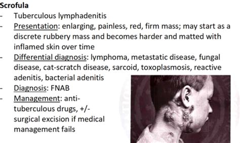 127 Tuberculosis Flashcards Quizlet