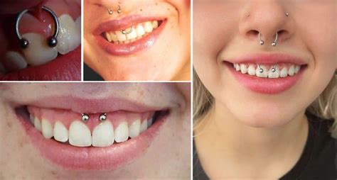 What Is A Smiley Piercing A Guide To Styling And Aftercare