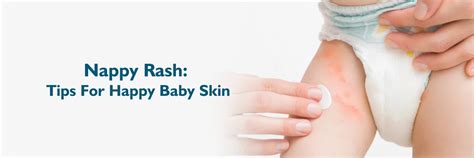 Nappy Rash: Causes, Prevention and Treatment