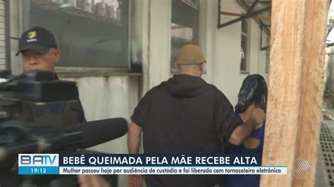 Beb Queimada Gua Fervente Em Salvador Recebe Alta Hospitalar Diz