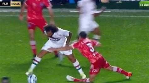 Marcelo Suspenso Ap S Quebrar Perna De Jogador