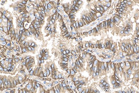 Cd Antibody Rr Proteintech