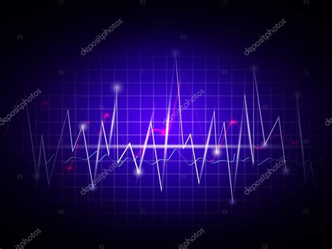 Cardiogram — Stock Vector © Razvodovska 5441750