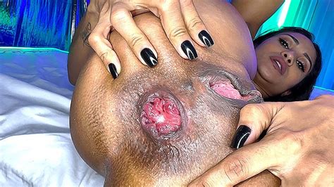 MILF Magrinha Flexivel Prolapso Seu Cu Pornhub