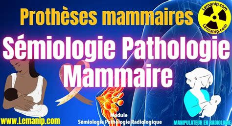 S Miologie Pathologie Radiologie Mammaire