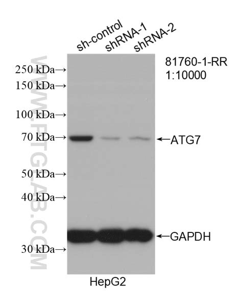 ATG7 Antibody 81760 1 RR Proteintech