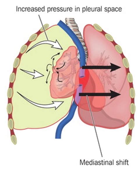 Abcde Assessment Lwems