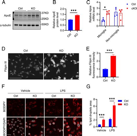 Autophagy Deficiency Modulates Microglial Lipid Homeostasis And