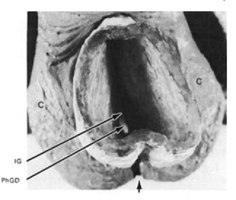 Figure 1 From Development Of Congenital Laryngeal Atresias And Clefts Semantic Scholar