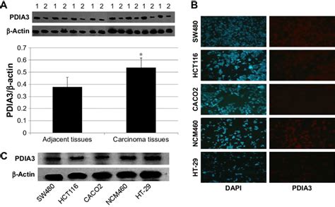 Expression Of Protein Disulfide Isomerase A3 Precursor Pdia3 Protein