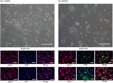 High Throughput Three Dimensional Spheroid Tumor Model Using A Novel