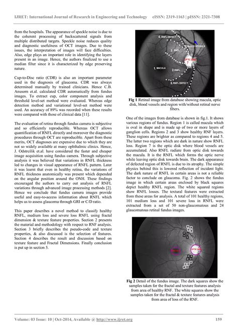 Early Detection Of Glaucoma Through Retinal Nerve Fiber Layer Analysis