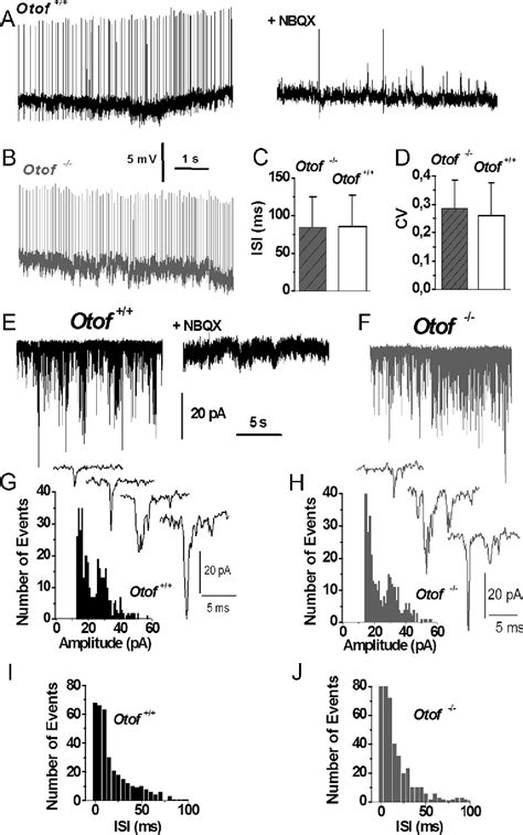 Figure 1 From Otoferlin Is Critical For A Highly Sensitive And Linear