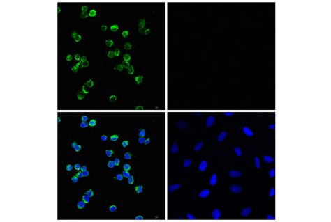 Myeloperoxidase E E I Xp Rabbit Mab Alexa Fluor Conjugate