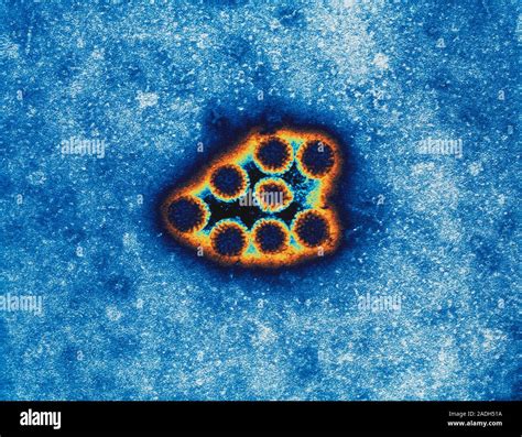 Los rotavirus Color micrógrafo electrónico de transmisión TEM de las