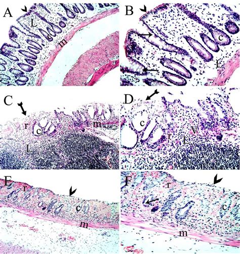 A B Photomicrograph Of A Paraffin Section Of Colonic Mucosa Of The