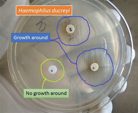 Haemophilus ducreyi : Introduction, Morphology, Pathogenesis, Lab Diag