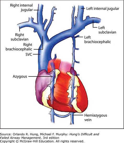 Airway Management of a Patient with Superior Vena Cava Obstruction ...