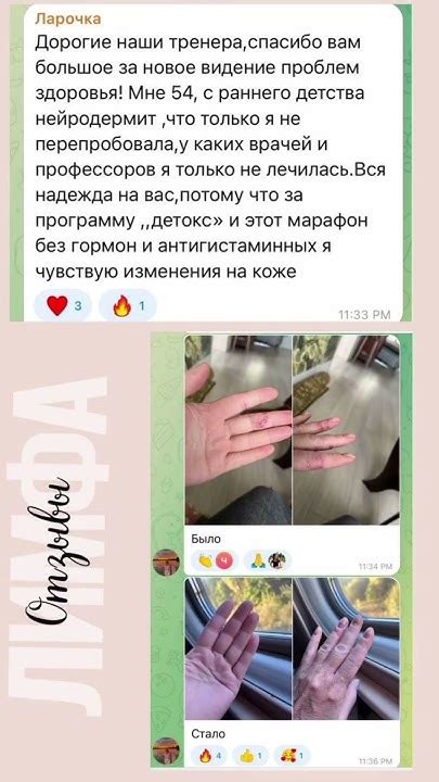 #отзывы #лимфа #жизнь #здоровье #женскоездоровье #старт #тест #зож # ...