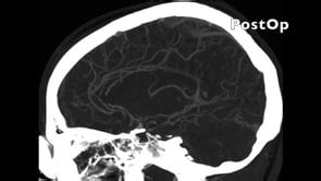 Surgical Neurology International