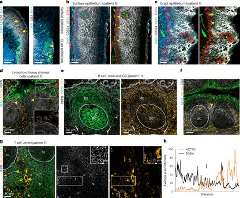 Pi Reticular Cells In Human Palatine Tonsils Govern T Cell Activity