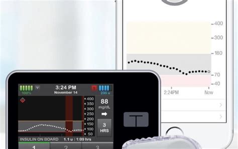 Tandem T Slim X2 And T Flex Insulin Pump Integrated Diabetes Services