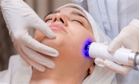 Morpheus 8 Radiofrequency Microneedling Dr Amal Abid Touzani