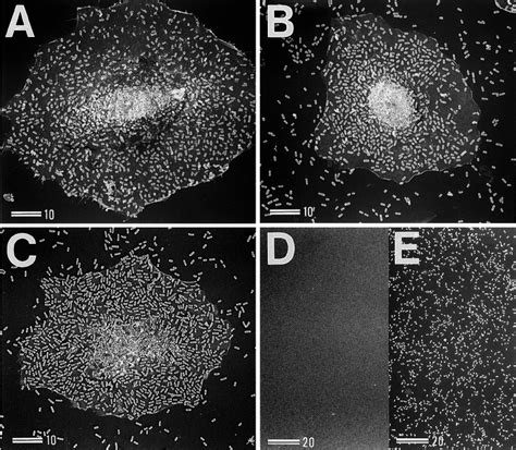 Scanning Electron Micrographs Showing Adherence To HeLa Cells And