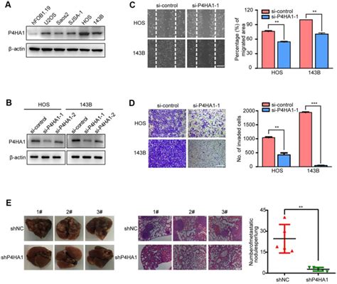 P Ha Promoted The Metastasis Of Os In Vitro A Western Blotting