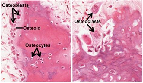 Bone Cells Under A Microscope