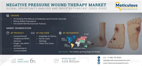 Negative Pressure Wound Therapy Npwt Market By Size Share Forecasts