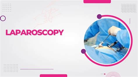 Best Laparoscopic Treatment In Bangalore Ovum Fertility